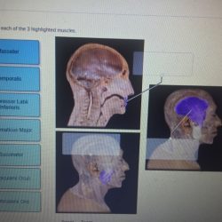 Correctly label each of the 3 highlighted muscles.