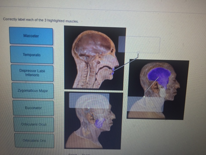 Correctly label each of the 3 highlighted muscles.