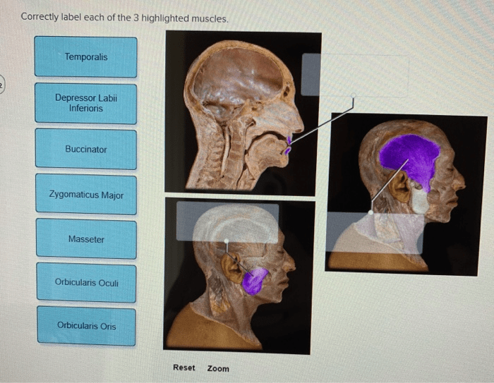 Correctly label each of the 3 highlighted muscles.